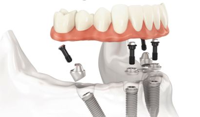 имплантация зубов в Израиле цены